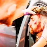 Car Crash Injuries